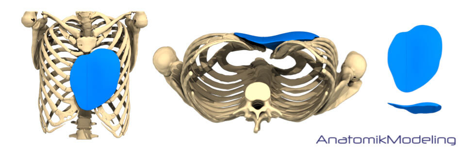 Trichterbrust OP Karlsruhe Anatomik Modeling - Dr. Weihrauch 