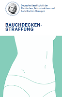 Patienteninformation zur Bauchdeckenstraffung 